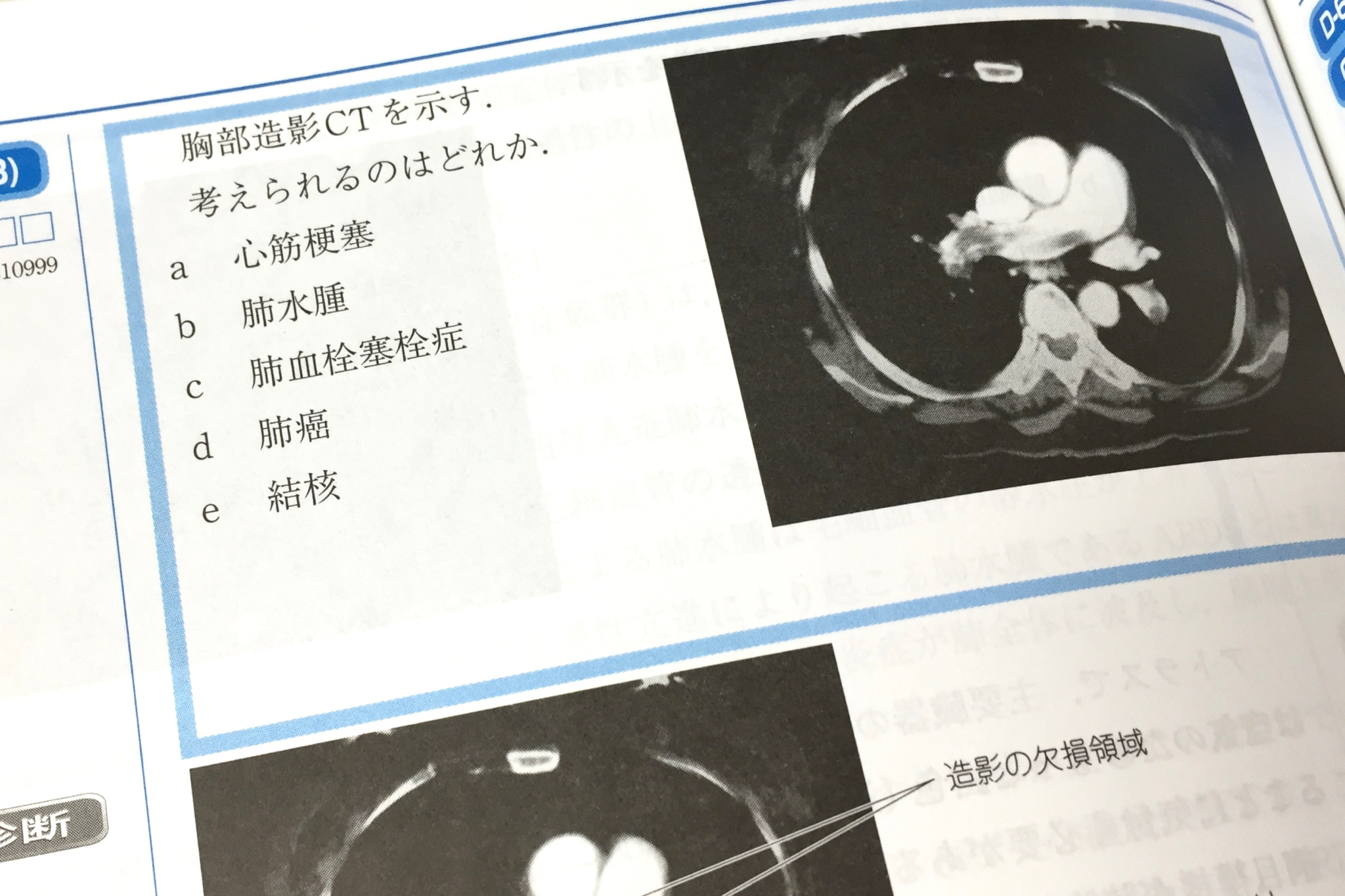 第2巻の画像診断の問題。解剖学の授業で見慣れておけば正解を推定できる。