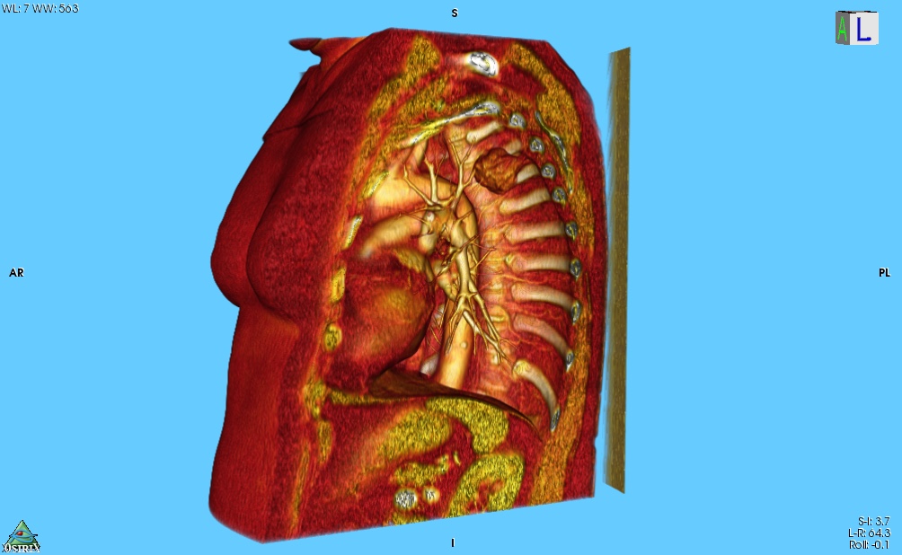 3d-vr-%e5%83%8f