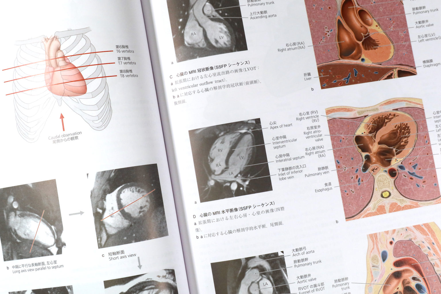 プロメテウス解剖学アトラス 胸部/腹部・骨盤部+golnoorclub.com