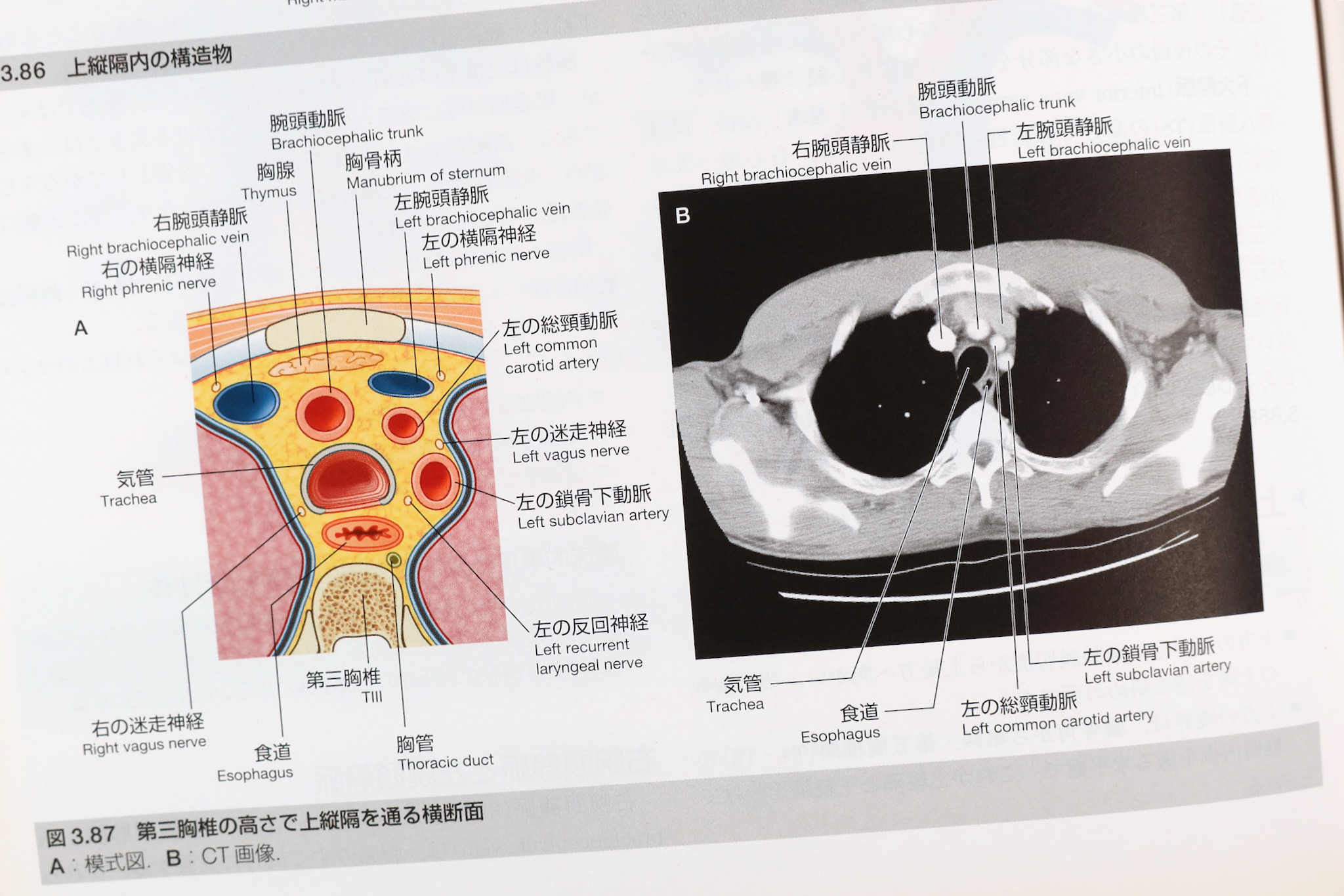 プロメテウス解剖学5冊、グレイ解剖学、画像で見る人体解剖