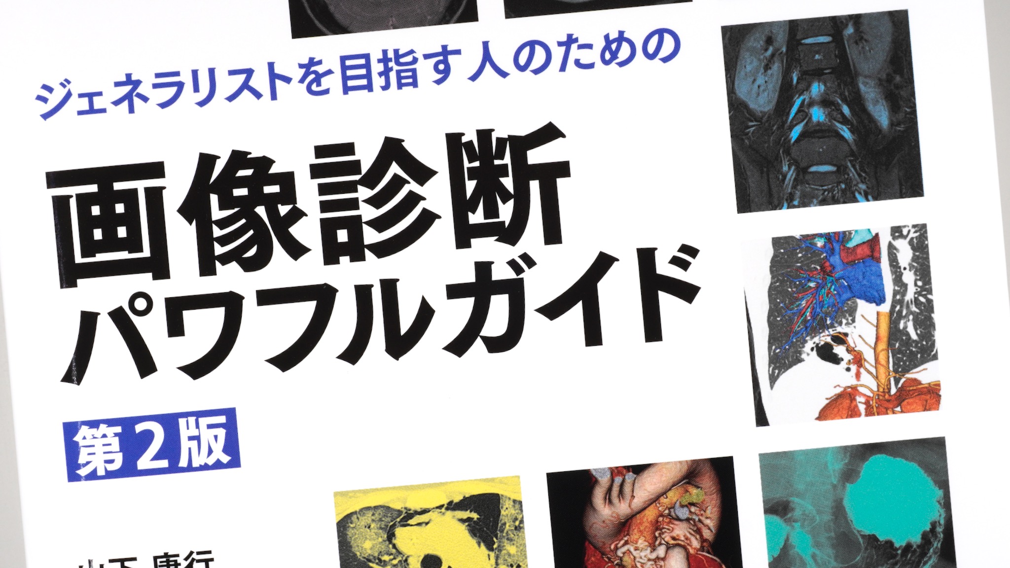 ジェネラリストを目指す人のための画像診断パワフルガイド 第2版